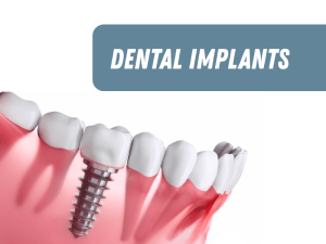 Illustration of a dental implant inside of a patient's mouth